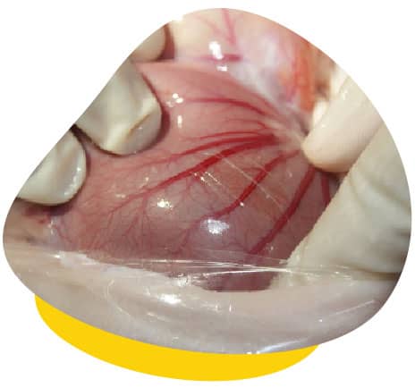 Gastric dilation surgery