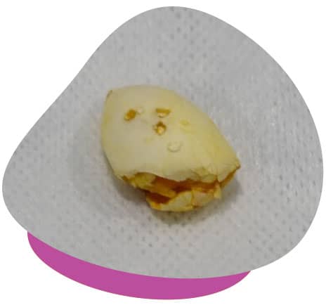 egg post surgery egg post surgery